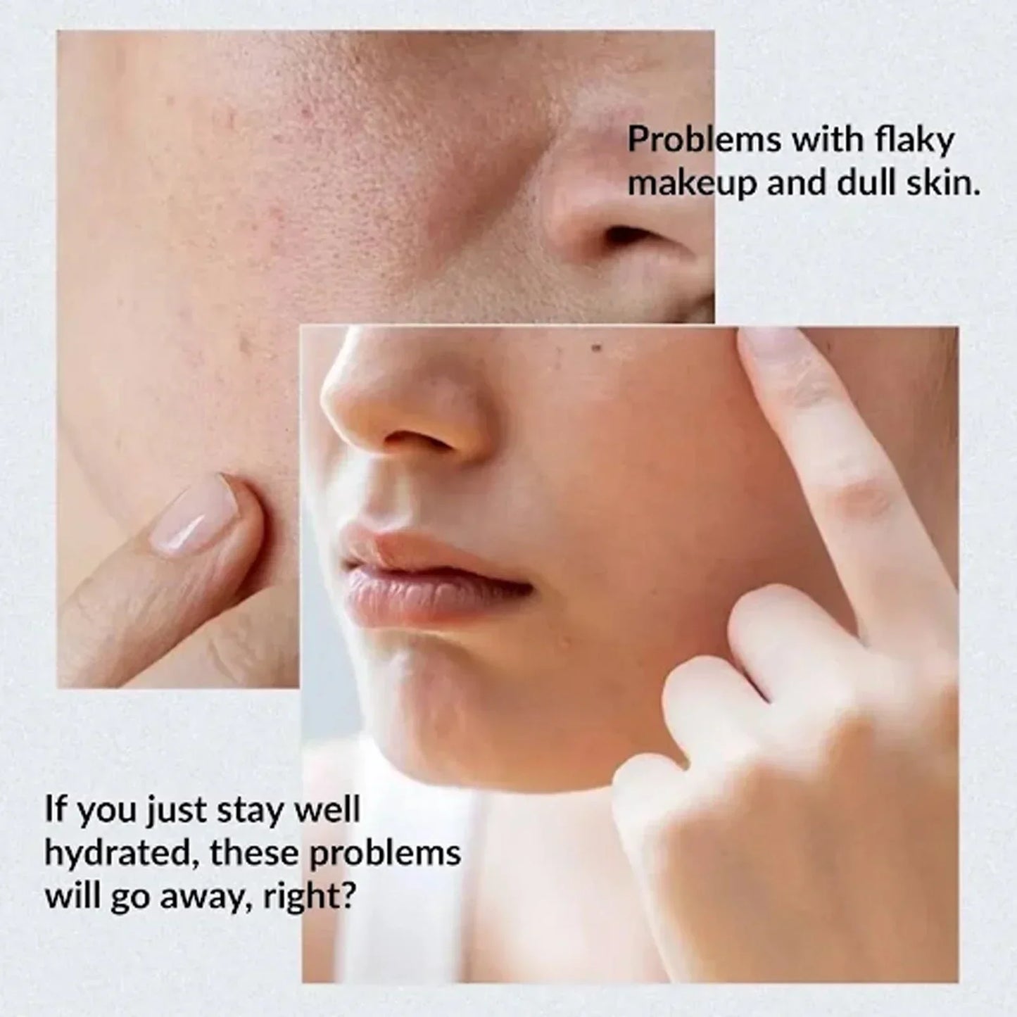 Anua Birch 70% Moisture Boosting Serum (30 ML)