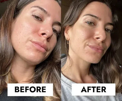 CeraVe Blemish Control Gel Moisturiser with 2% Salicylic Acid &amp; Niacinamide for Blemish-Prone Skin 40ml